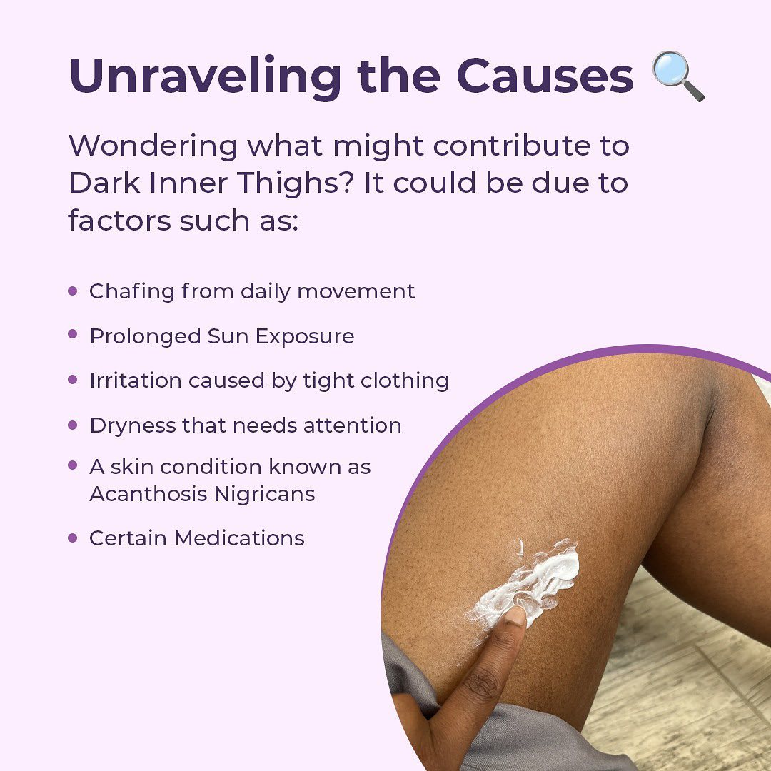 Dark Inner Thighs Cream