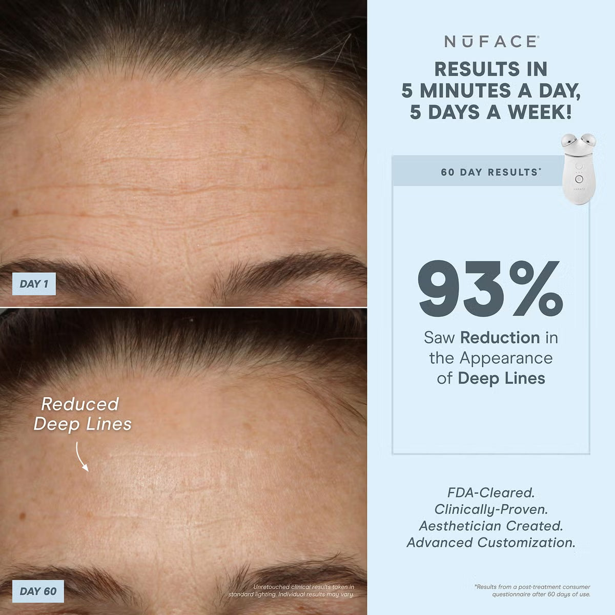 NuFACE Trinity+ LED and Wrinkle Reducer Attachment Set